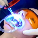 soft tissue lasers