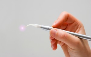 a tool used for laser dentistry