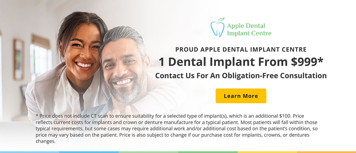 Apple Dental Implant Centre Member Banner